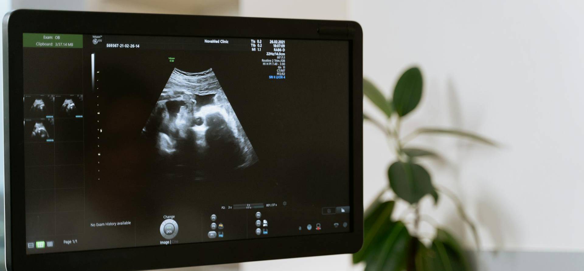 Ultrasound Test in South Delhi