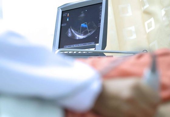 Echocardiography Test in South Delhi