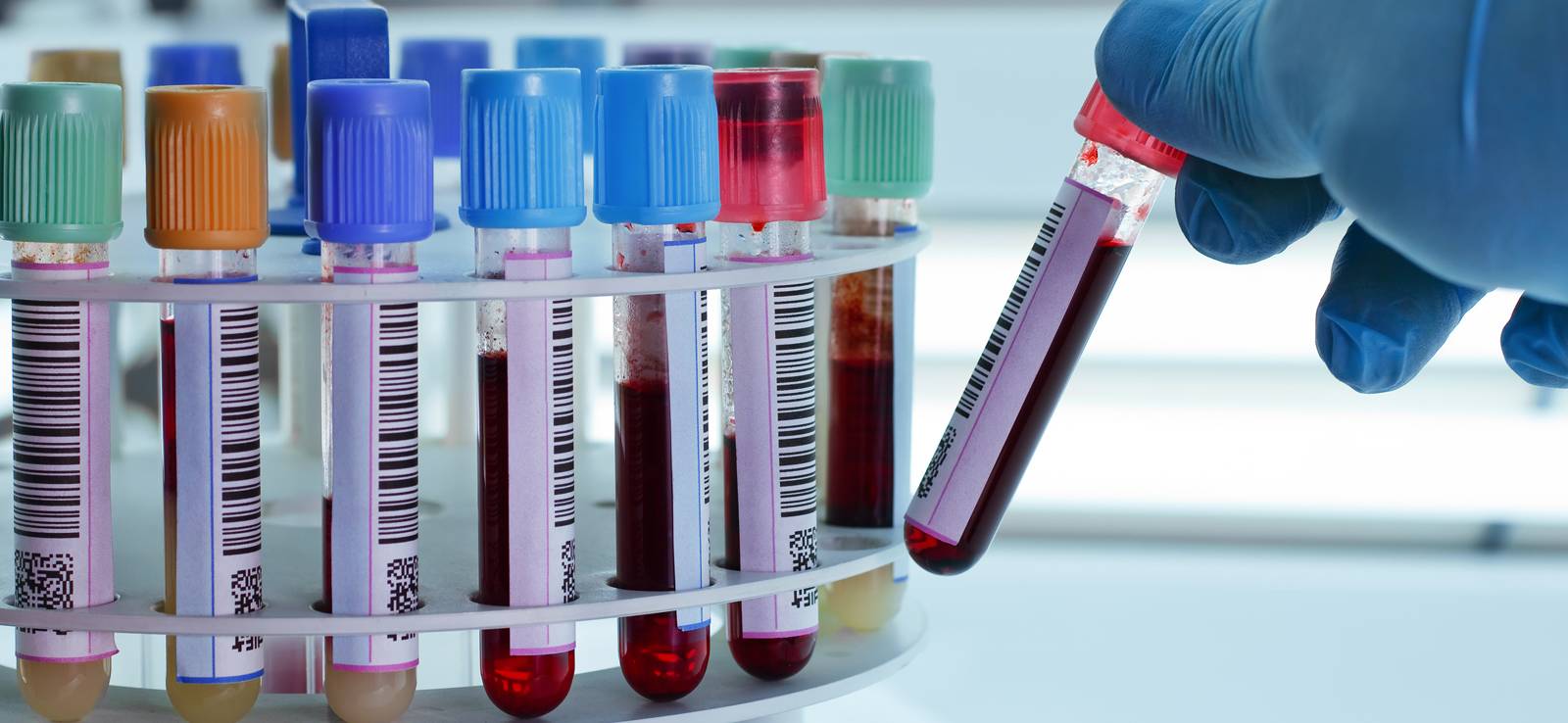 Full body Checkup in South Delhi