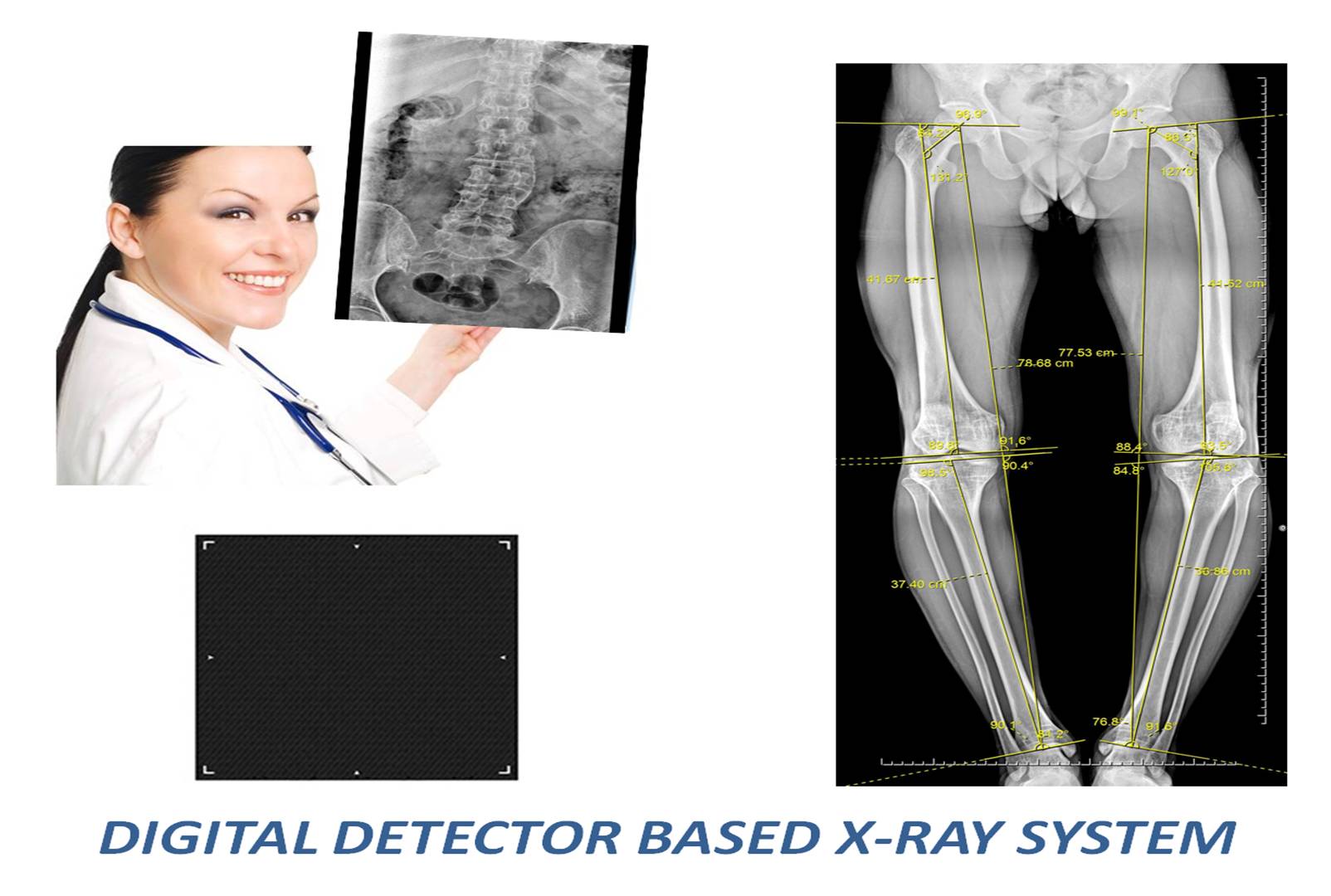 full-body x-ray in south delhi