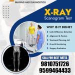 Scanogram Lower Limb Test in Delhi – X-Ray Scanogram Both Lower Limbs at Saksham Imaging