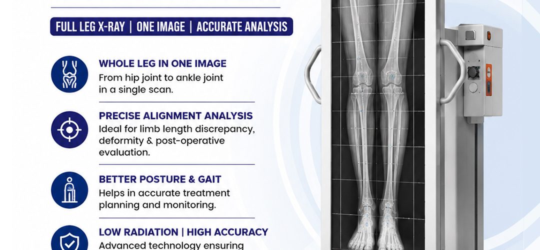 X Ray Scanogram of Both Lower Limbs