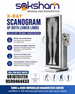 X Ray Scanogram of Both Lower Limbs