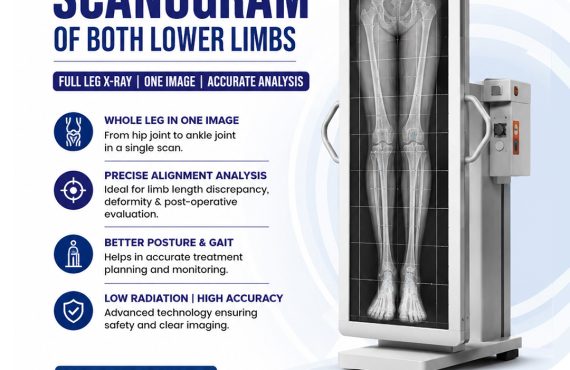 X Ray Scanogram of Both Lower Limbs